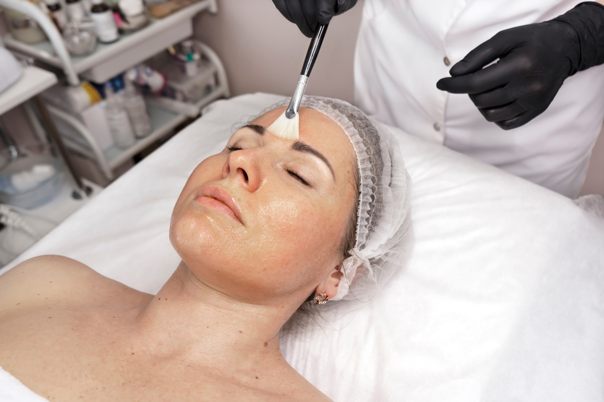 A person lying down receiving a chemical peel in Richmond.