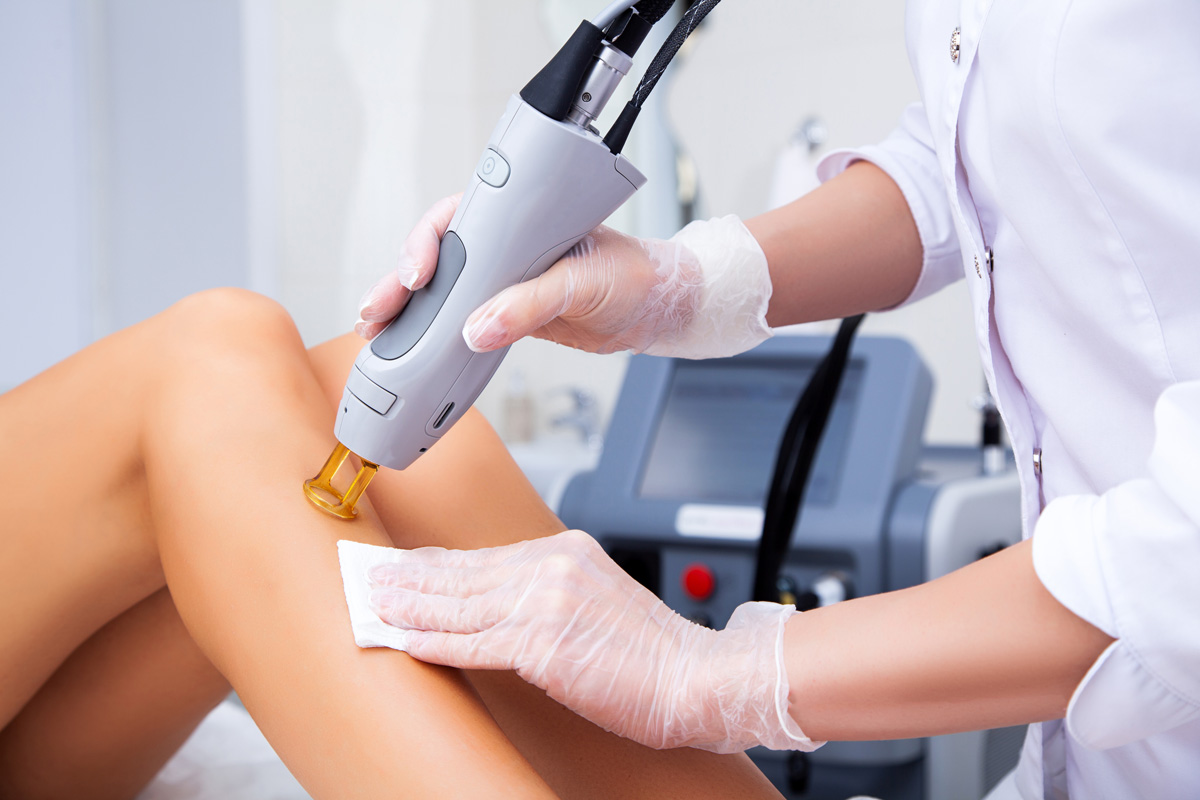 A person performing laser hair removal on a patient’s leg in Richmond.